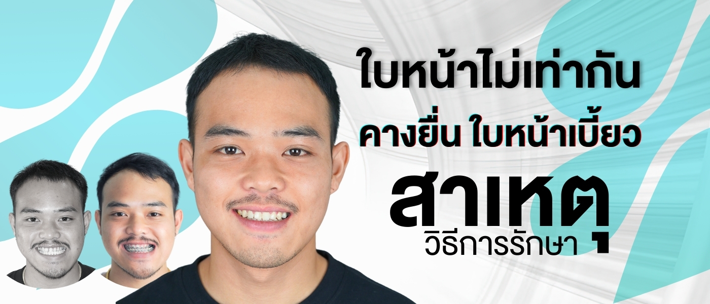 https://dev.totsapaetsurgery.com/wp-content/uploads/2026/03/เวป1400x600-2.jpg