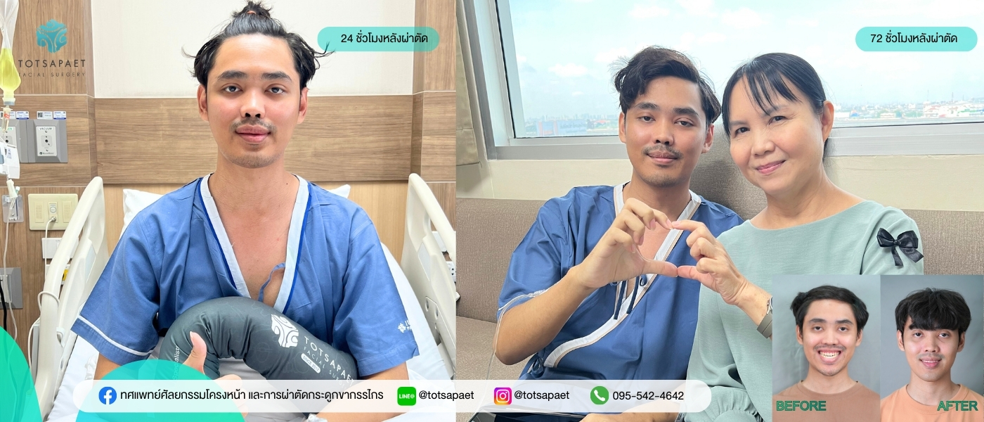 https://dev.totsapaetsurgery.com/wp-content/uploads/2026/03/เวป1400x600-3.jpg